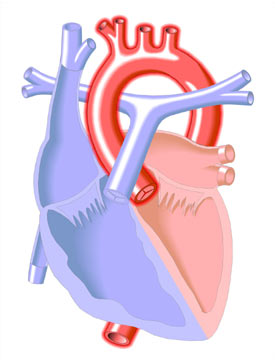 Hipertensin Sistmica
